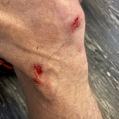 Knie